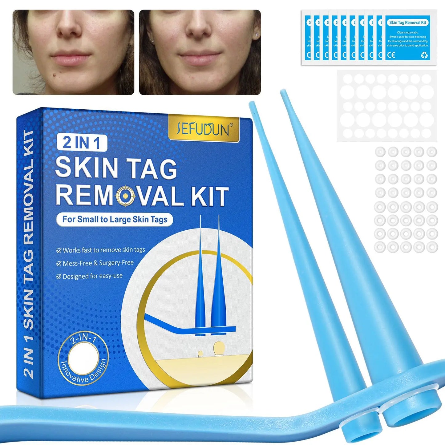 2-in-1 Auto Skin Tag Removal Kit