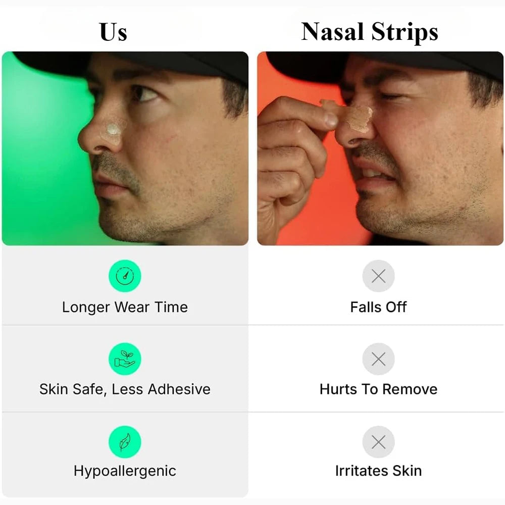 Skin-Safe Nasal Strips – Intake Breathing Starter Kit