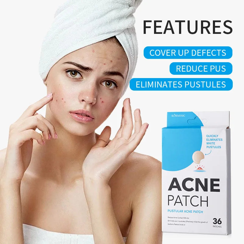 Acne Pimple Patches – Overnight Absorbing Stickers for Clearer Skin ✨